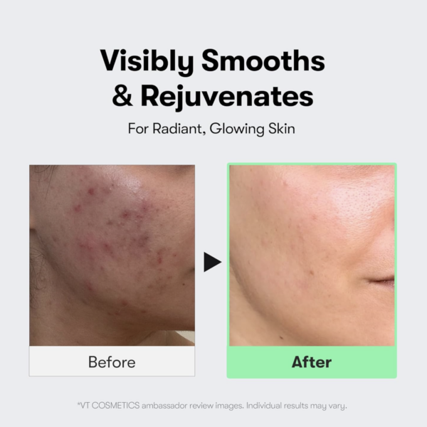 VT COSMETICS – Cica Reedle Shot 300 – Tratamiento Renovador y Refinador de Poros