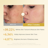 MEDICUBE – Kojic Acid Turmeric Resurfacing Toner 250 ml – Tónico Antimanchas Iluminador