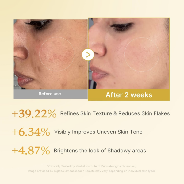 MEDICUBE – Kojic Acid Turmeric Resurfacing Toner 250 ml – Tónico Antimanchas Iluminador